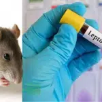 Mangaluru: Rat fever is on the rise again in the coastal areas.