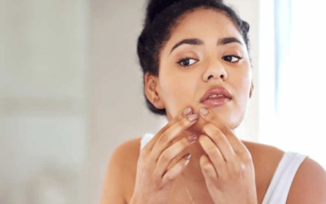 The habit of pinching acne is not good!