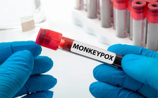 Canada confirms 1,444 monkeypox cases