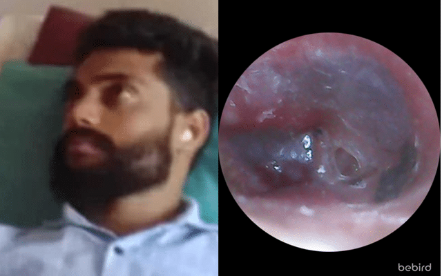 Torn eardrum of victim of police brutality: Scanning photos go viral